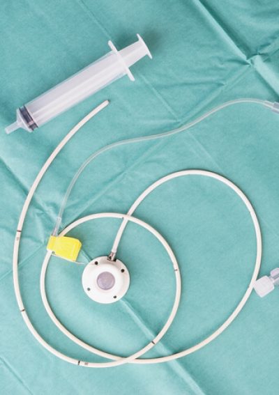 Port Catheter